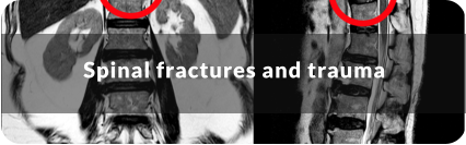 Senior woman holds the arm of a senior man as he walks with the help of a walker. They are looking at each other and smiling. Title reads: Hip Replacement