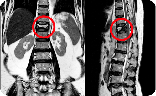 A senior man and woman outside on a sunny day. The man is leaning on a walker, and the woman is holding his arm affectionately. There are a lot of trees and other greenery in the background.